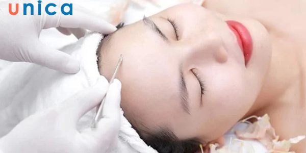 Trị mụn ẩn chuẩn y khoa
