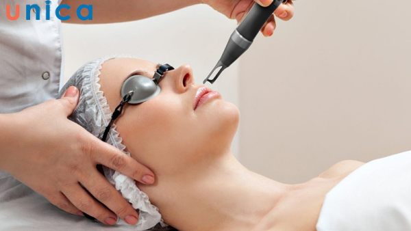 Đây là kỹ thuật trị mụn sử dụng hai lần chiếu ánh sáng Elight