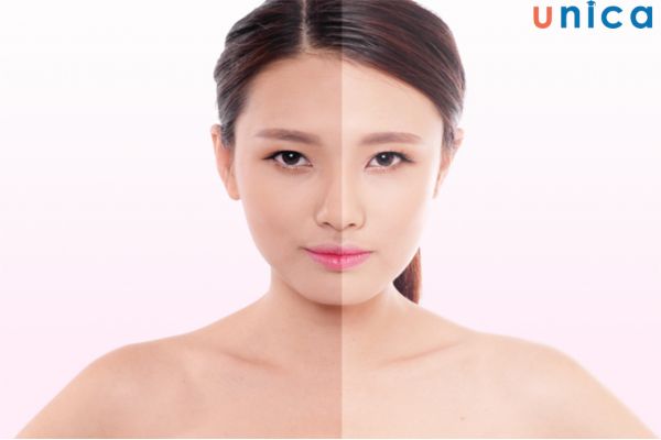 Da đen bẩm sinh có thể trắng lại được nếu biết cách chăm sóc