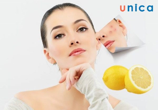 Chỉ đắp mặt nạ chanh trong 20 phút