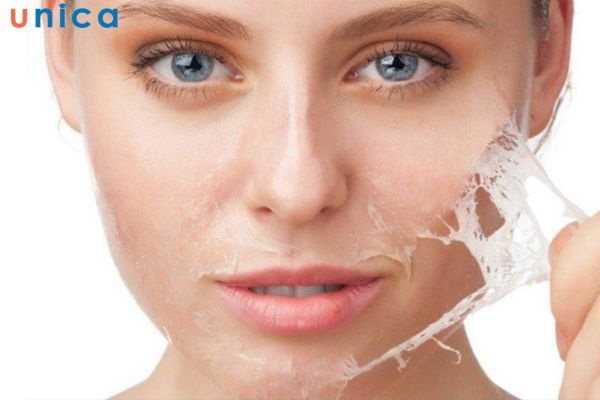 Những lưu ý giúp da nhanh hồi phục sau khi peel