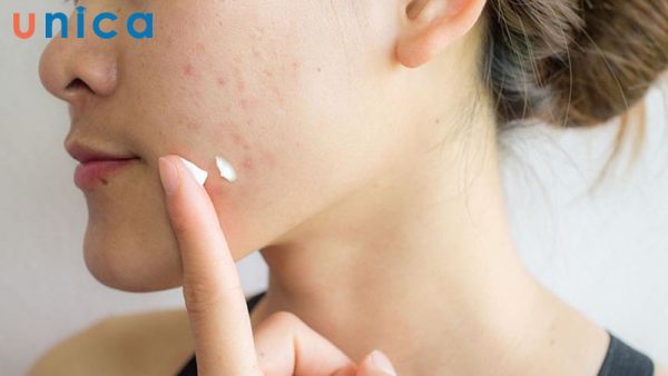 Sử dụng sản phẩm chăm sóc da không phù hợp có thể làm da mặt bị đổ nhiều dầu