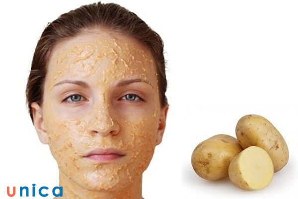 Đắp mặt nạ khoai tây nguyên chất để trị mụn