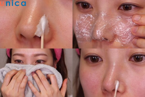 Trị mụn đầu đen bằng Vaseline