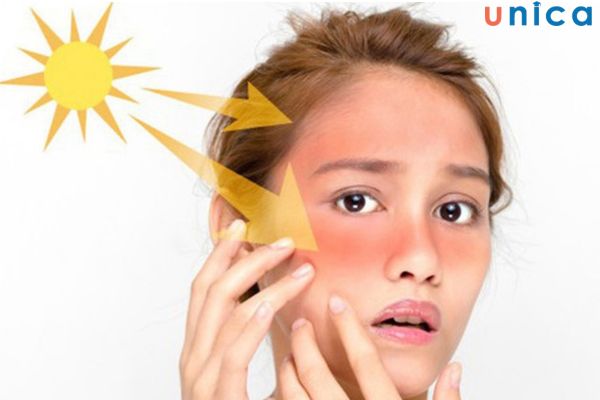 Ảnh hưởng của ánh nắng mặt trời