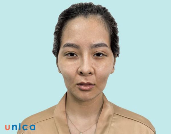 Khắc Phục Khuôn Mặt Già Trước Tuổi: Những Bí Quyết Hiệu Quả Để Lấy Lại Sự Tươi Trẻ