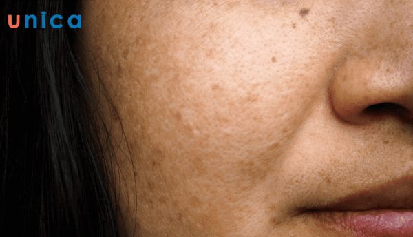 Da xỉn màu có thể xuất phát từ rất nhiều nguyên nhân