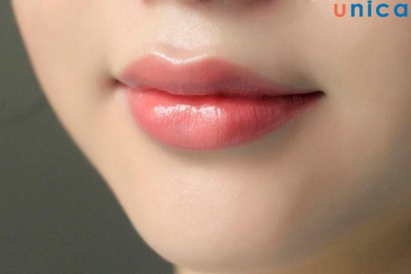 Tái khám định kỳ theo lịch để xem môi có gì bất thường không