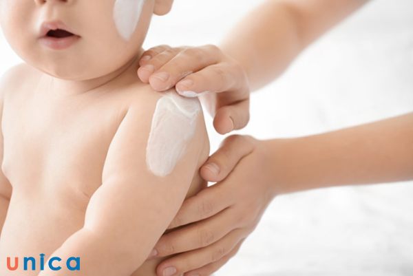 Hạn chế thoa kem lên vùng da bé đang bị rôm sẩy