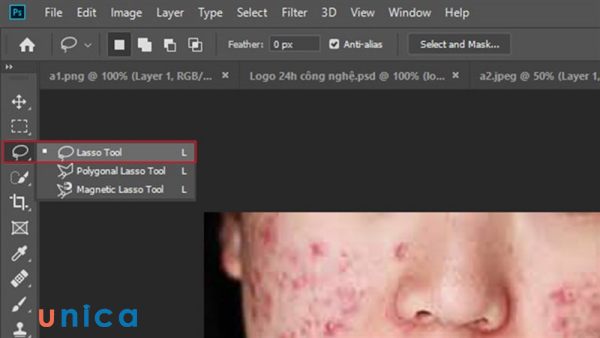 Sử dụng công cụ Lasso Tool (phím tắt L) để chọn vùng da có mụn