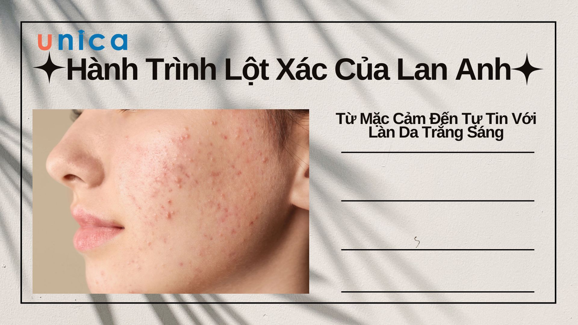 Hành Trình Lột Xác Của Lan Anh: Từ Mặc Cảm Đến Tự Tin Với Làn Da Trắng Sáng