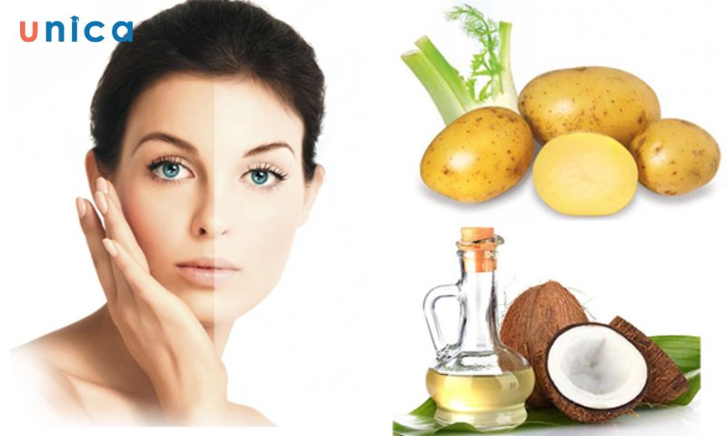 Mặt nạ khoai tây dầu dừa
