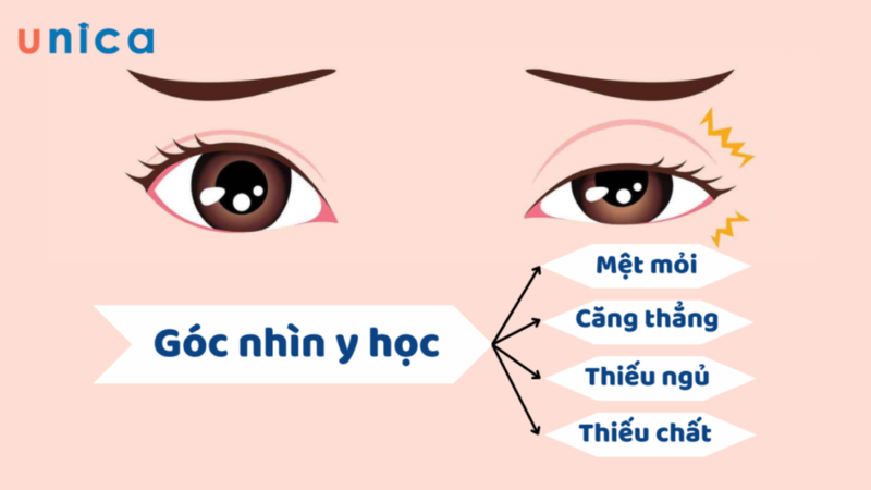 Căng thẳng, mệt mỏi, thiếu ngủ là nguyên nhân hàng đầu