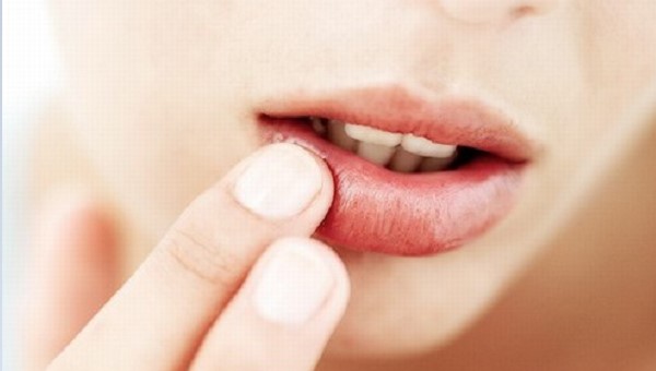 Góc giải đáp: Sau khi xăm môi nên bôi gì ?