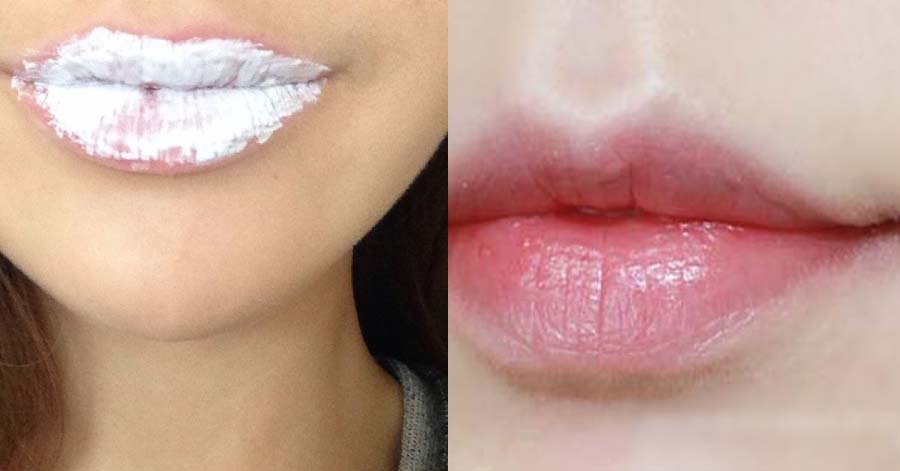 3 cách trị thâm môi bằng kem đánh răng