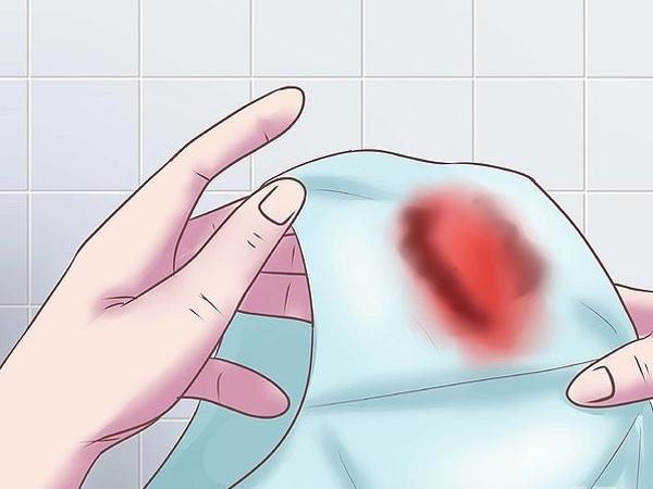 Ra máu khi mang thai có nguy hiểm không